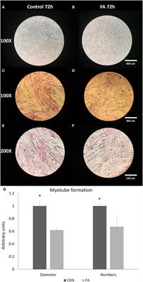 Effect of Eicosapentaenoic Acid and Docosahexaenoic Acid on Myogenesis and Mitochondrial Biosynthesis during Murine Skeletal Muscle Cell Differentiation